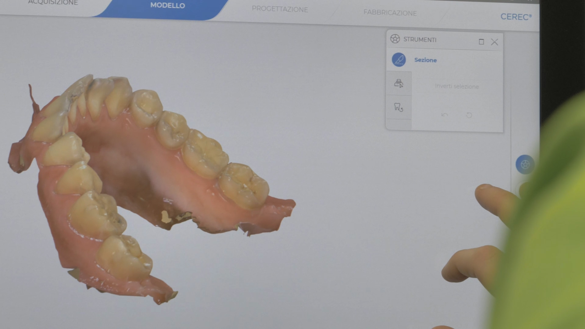 Schermo del sistema CEREC con il modello 3D del dente in progettazione