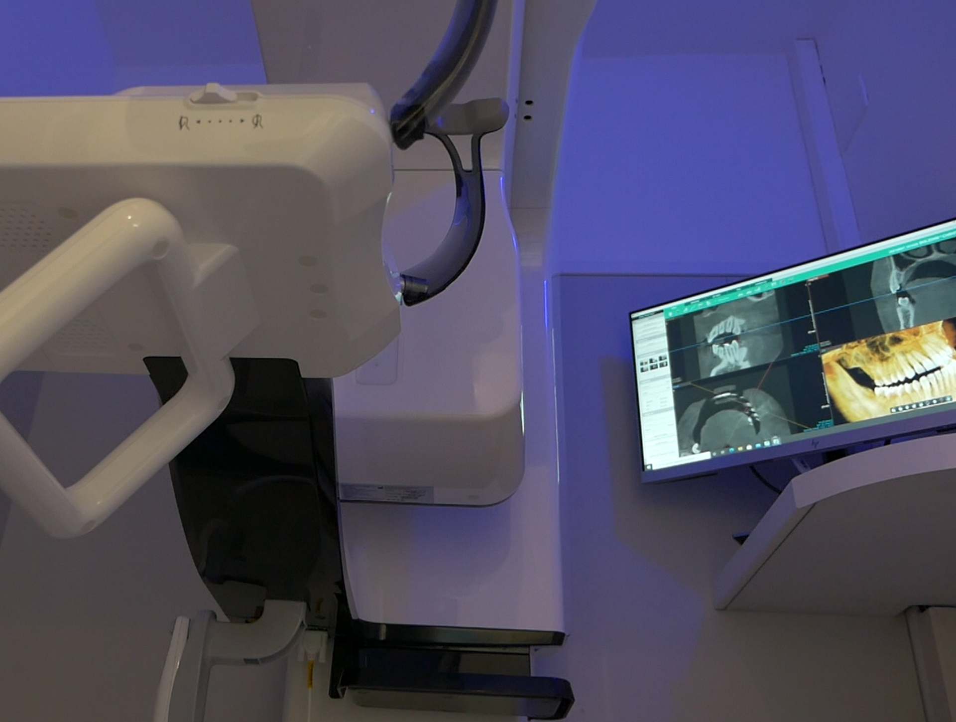 Apparecchio di radiologia 3D con monitor che mostra le immagini CBCT